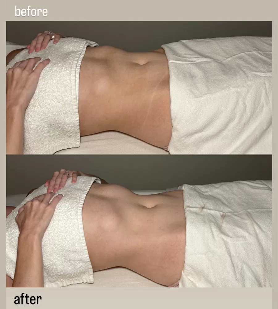 Brazilian-Lymphatic-Drainage-Massage-photo-1-For-Healths-Sake-Toronto-Ontario.jpg