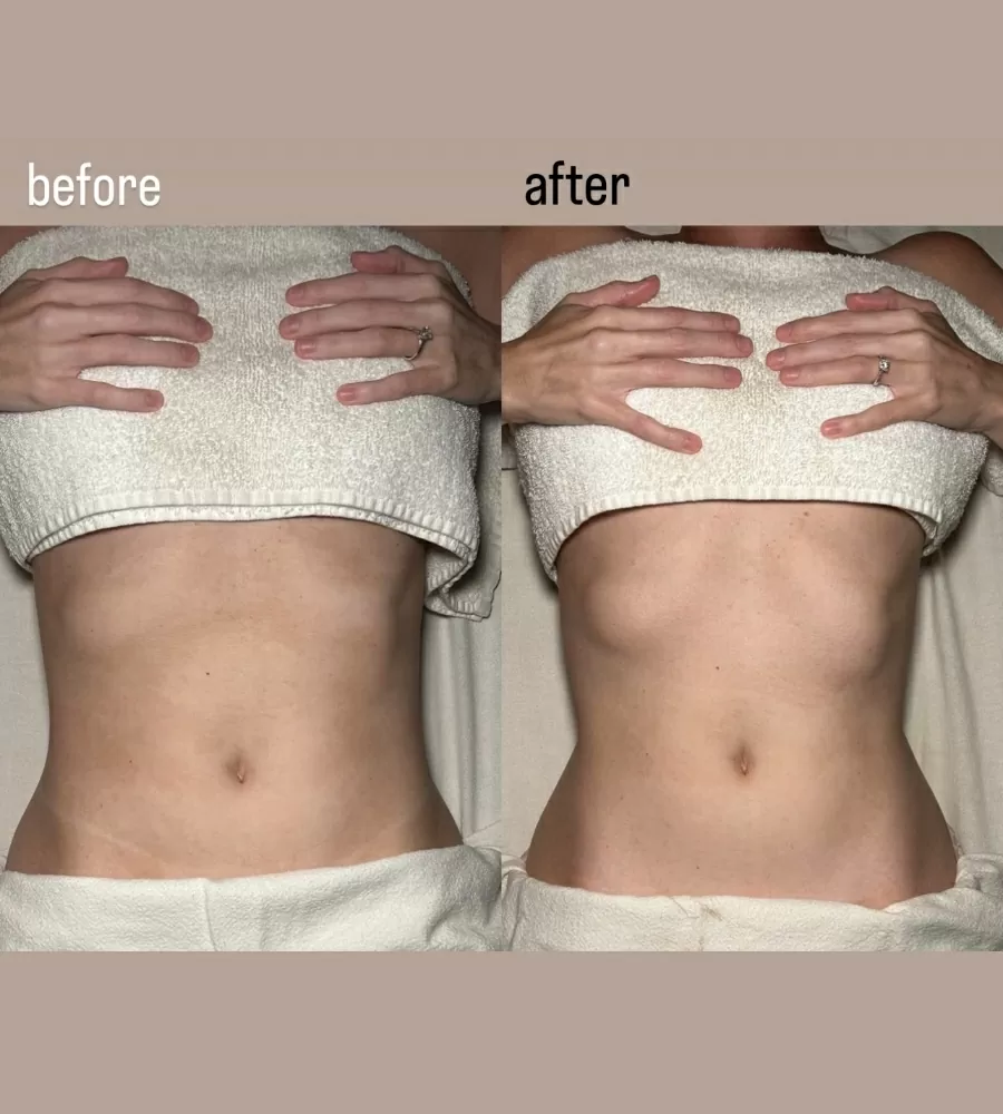 Brazilian-Lymphatic-Drainage-Massage-photo-2-For-Healths-Sake-Toronto-Ontario.jpg