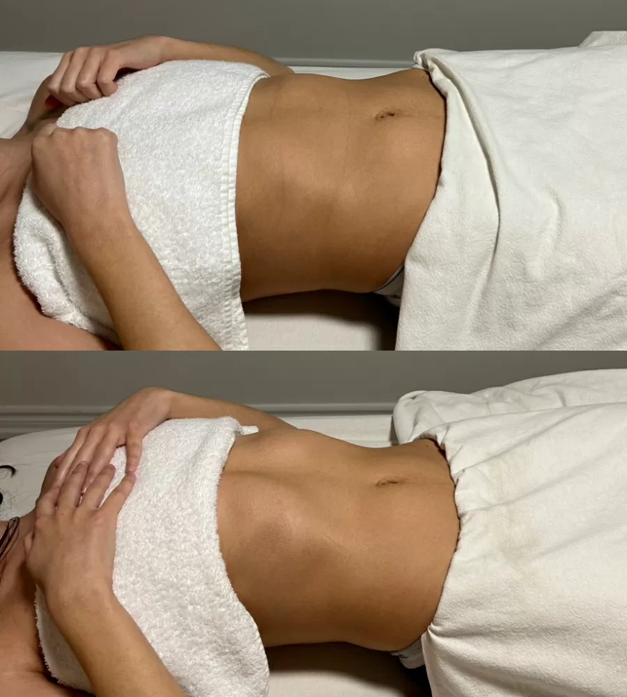 Brazilian-Lymphatic-Drainage-Massage-photo-3-For-Healths-Sake-Toronto-Ontario.jpg
