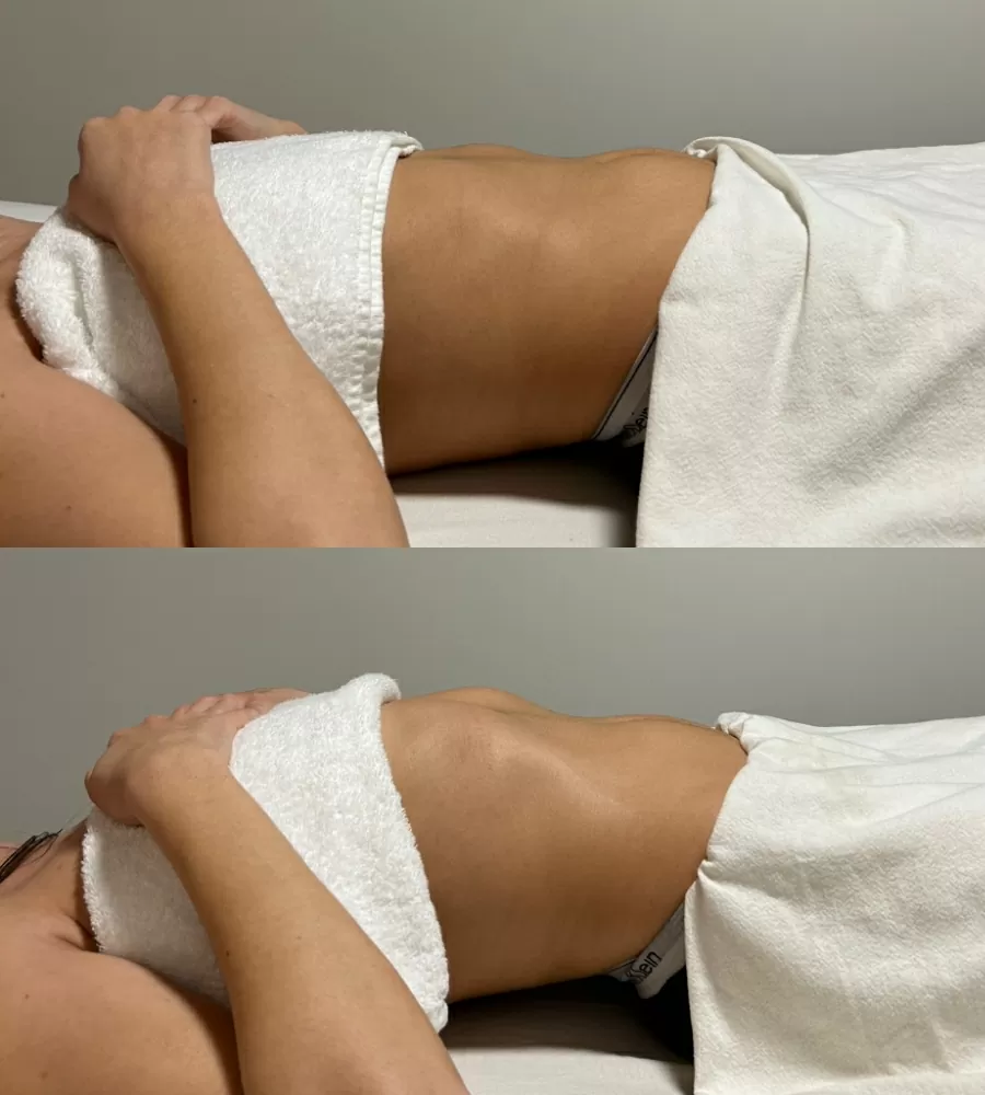 Brazilian-Lymphatic-Drainage-Massage-photo-4-For-Healths-Sake-Toronto-Ontario.jpg